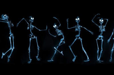 Dancing Skeletons X ray Dancing Skeletons X ray